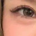 レーザートーニング（美白・肝斑） 渋谷美容外科クリニック 新橋院 BEFORE サムネイル用