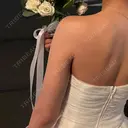 インディバ（二の腕） 渋谷美容外科クリニック 池袋院 BEFORE サムネイル用