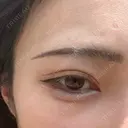 アートメイク（眉） Kinshicho Beauty Clinic （錦糸町ビューティークリニック） BEFORE サムネイル用