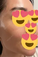 RF（高周波）たるみ治療 渋谷美容外科クリニック 渋谷院 BEFORE サムネイル用