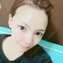 二重切開 / 目頭切開 / 眼瞼下垂（切開） / 軟骨移植 / 骨切幅寄せ / 斜鼻修正 id（アイディ）美容外科 BEFORE サムネイル用