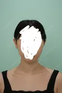脂肪吸引（顔） / ボトックス（エラ・小顔） WOM CLINIC GINZA （ワム クリニック ギンザ） BEFORE サムネイル用