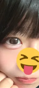 二重埋没 / 目頭切開 / 糸リフト / クマ治療 / 脂肪吸引（顔） / 上まぶたの脂肪取り / ジョールファット除去 ルラ美容クリニック 渋谷本院 BEFORE サムネイル用