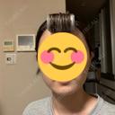 ボトックス（あご） / ボトックス（エラ・小顔） TCB東京中央美容外科 自由が丘院 BEFORE サムネイル用