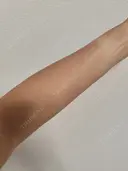 白玉点滴・注射 城本クリニック 大阪院 BEFORE サムネイル用