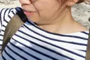 脂肪吸引（顔） 湘南美容クリニック 松戸院 BEFORE サムネイル用