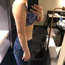 脂肪溶解注射（二の腕） 明洞トックスエンフィル BEFORE サムネイル用