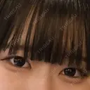 ヒアルロン酸注入（涙袋） / その他（輪郭） ルラ美容クリニック 岐阜院 BEFORE サムネイル用