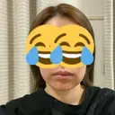 ボトックス（あご） / ボトックス（エラ・小顔） / 脂肪溶解注射（顔） / ボトックス（口角） / ボトックス（首） M'sクリニック【エムズクリニック】 BEFORE サムネイル用