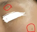 シミ取りレーザー さっぽろ美容クリニック BEFORE サムネイル用