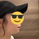 ヒアルロン酸注入（あご） / ボトックス（エラ・小顔） ルラ美容クリニック 千葉院 / ルラスキンクリニック 千葉院 BEFORE サムネイル用