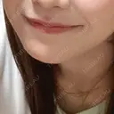 ボトックス（あご） ルラ美容クリニック 千葉院 / ルラスキンクリニック 千葉院 BEFORE サムネイル用