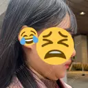 脂肪吸引（顔） / ネックリフト リラ・クラニオフェイシャル・クリニック BEFORE サムネイル用