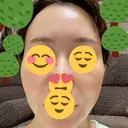 肌育注射（ジュベルックなど） / リジュラン 城本クリニック 大阪院 BEFORE サムネイル用