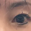 眉下切開 MOMO CLINIC BEFORE サムネイル用