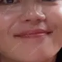 ヴェルヴェットスキン RainBoW Clinic TOKYO BEFORE サムネイル用