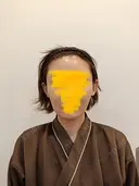 糸リフト / 脂肪吸引（顔） / ジョールファット除去 RIVER CLINIC（リバークリニック） BEFORE サムネイル用