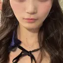 メーラーファット除去 / ハイフ（顔） A CLINIC（エークリニック） 新宿院 BEFORE サムネイル用