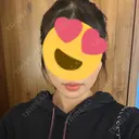 ヒアルロン酸注入（あご） HAAB BEAUTY CLINIC 名古屋院 BEFORE サムネイル用