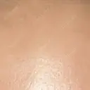 プラセンタ注射 新宿駅三丁目クリニック BEFORE サムネイル用