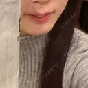 ヒアルロン酸注入（あご） HAAB×DREAM BEAUTY CLINIC 大阪梅田院 BEFORE サムネイル用