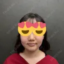 脂肪吸引（顔） ネビュラクリニック 京都院 BEFORE サムネイル用