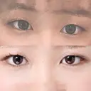 二重埋没 高須クリニック 名古屋院 BEFORE サムネイル用