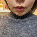 糸リフト Days Beauty Clinic 本厚木院 BEFORE サムネイル用