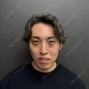 クマ治療 / ヒアルロン酸注入（目の下） / その他（目元） ネビュラクリニック 京都院 BEFORE サムネイル用