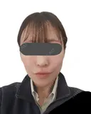 シワ取りボトックス / ピコレーザートーニング（美白・肝斑） / ピコフラクショナルレーザー（毛穴・ニキビ跡） 東京シルククリニック 東京神田院 BEFORE サムネイル用