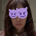 ヒアルロン酸注入（唇） / オリジオ HAAB×DREAM BEAUTY CLINIC 東京本院 BEFORE サムネイル用