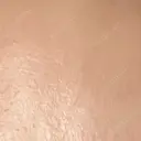 プラセンタ注射 新宿駅三丁目クリニック BEFORE サムネイル用