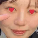 ピコレーザートーニング（美白・肝斑） 東京美容皮膚科アロエクリニック池袋 BEFORE サムネイル用