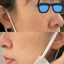 ルメッカ Evergreen medical clinic BEFORE サムネイル用