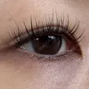 ヒアルロン酸注入（涙袋） 静岡中央クリニック BEFORE サムネイル用