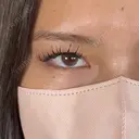 二重埋没 / 上まぶたの脂肪取り / 口角挙上 / ヒアルロン酸注入（涙袋） / ボトックス（エラ・小顔） / ヒアルロン酸注入（唇） / ボトックス（肩） アリエル美容クリニック 大宮院 BEFORE サムネイル用