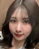 糸リフト / バッカルファット除去 / 脂肪吸引（顔） / 脂肪注入（額） / ジョールファット除去 First Clinic BEFORE サムネイル用