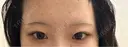 アートメイク（眉） G MEDICAL ART クリニック 新宿院 BEFORE サムネイル用