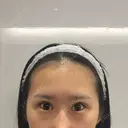 目尻切開 / タレ目形成・グラマラスライン（切開） BIANCA銀座 BEFORE サムネイル用