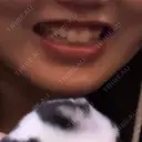ボトックス（エラ・小顔） / ボトックス（口角） / ボトックス（ガミースマイル） YBC横浜美容外科 立川院 BEFORE サムネイル用