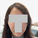 RF（高周波）たるみ治療 / インモード plume clinic BEFORE サムネイル用