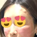 デンシティ Lumiera Clinic BEFORE サムネイル用