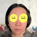 脂肪溶解注射（顔） ルラ美容クリニック 仙台院 / ルラスキンクリニック 仙台院 BEFORE サムネイル用