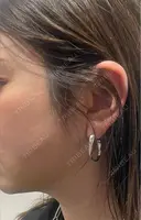 ハイフ（顔） Natural Skin Clinic 自由ヶ丘院 BEFORE サムネイル用