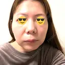 クマ治療 / 小鼻縮小（非切開） / ボトックス（あご） / ボトックス（エラ・小顔） / ボトックス（口角） TCB東京中央美容外科 新潟院 BEFORE サムネイル用