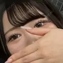 二重埋没 ルラ美容クリニック 大阪本院 BEFORE サムネイル用
