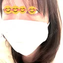 クマ治療 / 下まぶたたるみ取り / 下まぶたの脂肪取り 千葉美容外科アイビークリニック BEFORE サムネイル用