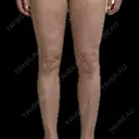 脂肪吸引（脚） / 脂肪吸引（お尻） / 脂肪吸引（腰） GAYA body design clinic BEFORE サムネイル用