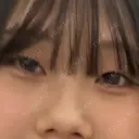 ヒアルロン酸注入（涙袋） フィラークリニック 大阪心斎橋院 BEFORE サムネイル用