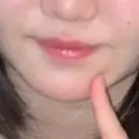 ヒアルロン酸注入（唇） / ボトックス（タレ目） ルラ美容クリニック 仙台院 / ルラスキンクリニック 仙台院 BEFORE サムネイル用